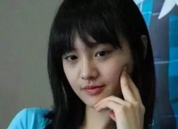 打玻尿酸最惨的女明星