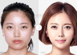 鼻子好看的图片,探寻完美鼻型的艺术魅力